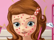 Squeeze Sofia Pimples Game