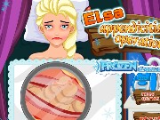Elsa Appendicitis Operation Game