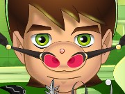 Ben 10 Nose Doctor Game