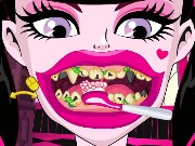 Draculaura Bad Teeth Game