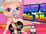 Baby Elsa Skin Allergy Game