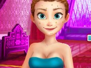 Frozen Anna Natural Makeover Game