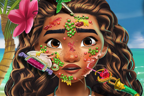 Moana Skin Doctor Game