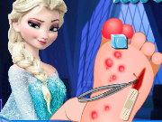 Frozen Foot surgery