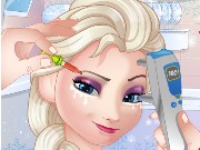 Elsa Eye Doctor