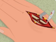 Hand Surgery Game